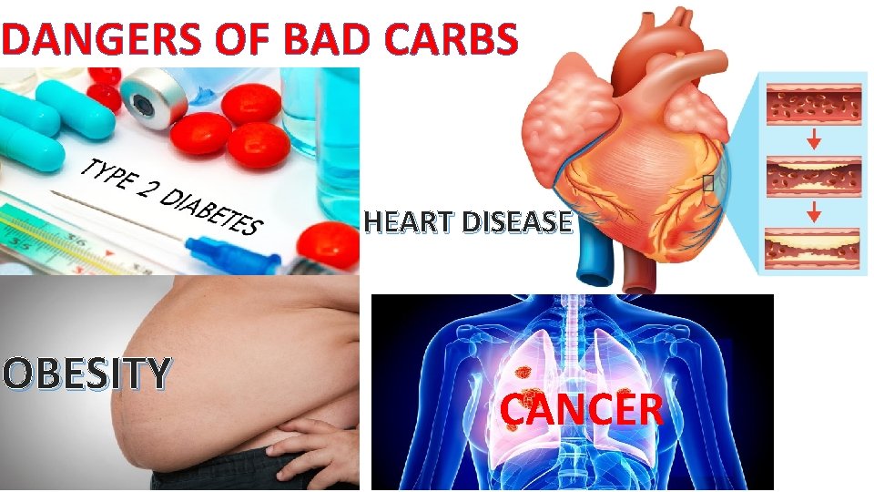 DANGERS OF BAD CARBS HEART DISEASE OBESITY CANCER 