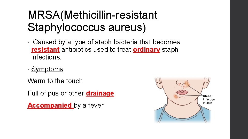 MRSA(Methicillin-resistant Staphylococcus aureus) • Caused by a type of staph bacteria that becomes resistant