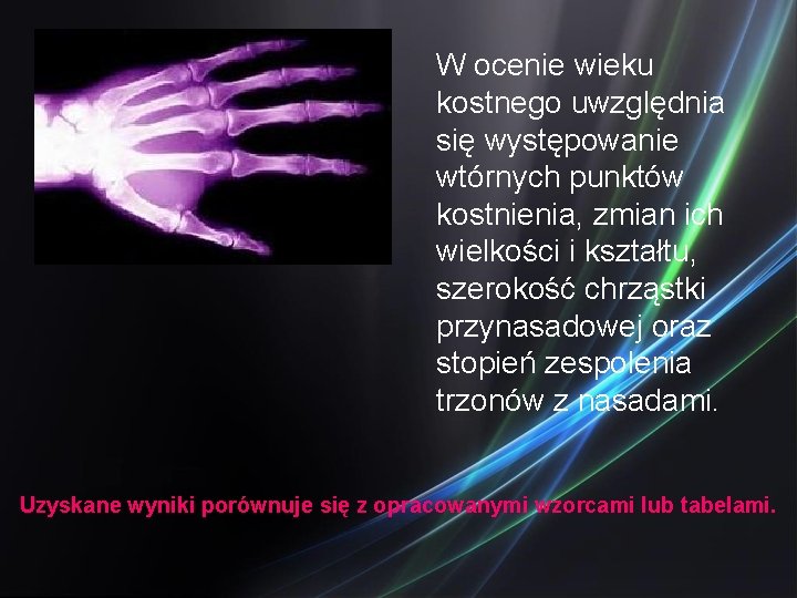 W ocenie wieku kostnego uwzględnia się występowanie wtórnych punktów kostnienia, zmian ich wielkości i