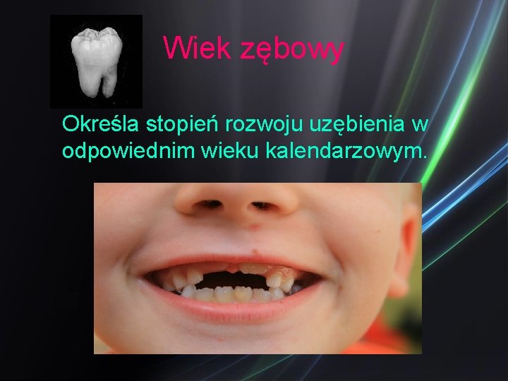 Wiek zębowy Określa stopień rozwoju uzębienia w odpowiednim wieku kalendarzowym. 