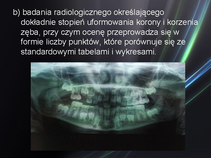 b) badania radiologicznego określającego dokładnie stopień uformowania korony i korzenia zęba, przy czym ocenę