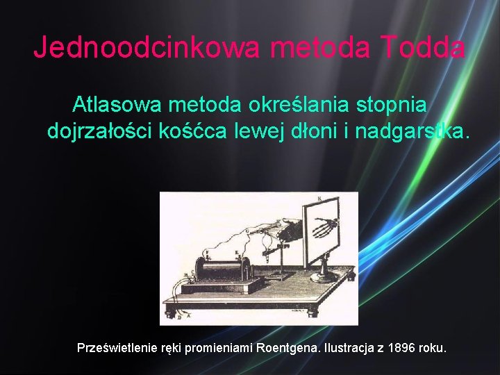 Jednoodcinkowa metoda Todda Atlasowa metoda określania stopnia dojrzałości kośćca lewej dłoni i nadgarstka. Prześwietlenie