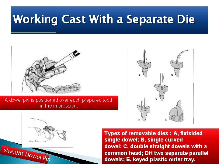 Working Cast With a Separate Die A dowel pin is positioned over each prepared