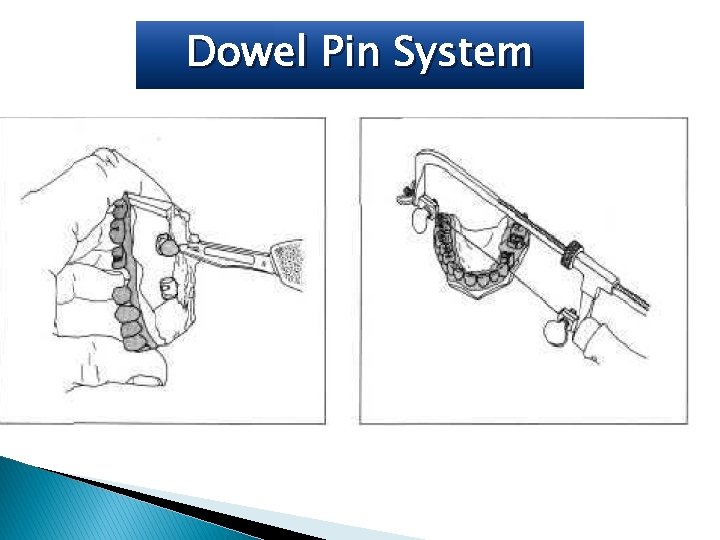 Dowel Pin System 