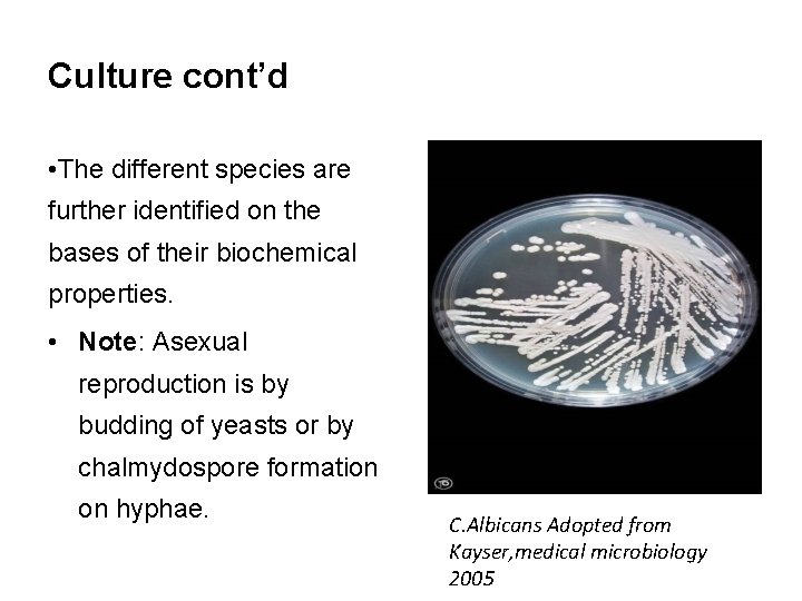 Culture cont’d • The different species are further identified on the bases of their