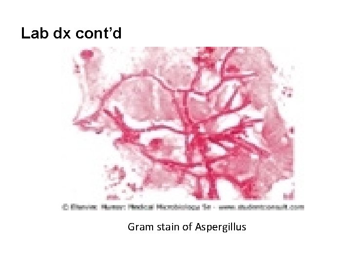 Lab dx cont’d Gram stain of Aspergillus 