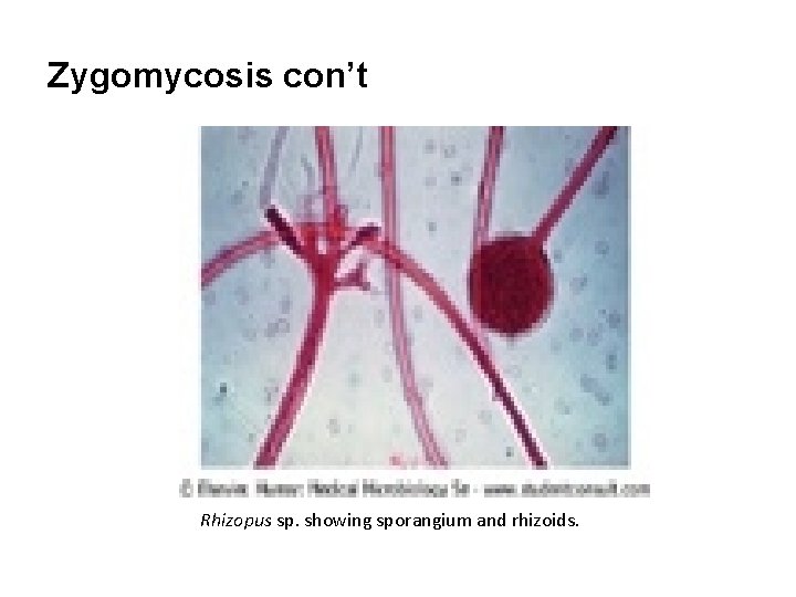 Zygomycosis con’t Rhizopus sp. showing sporangium and rhizoids. 