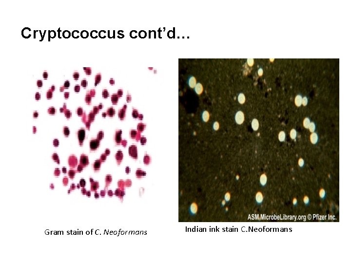 Cryptococcus cont’d… Gram stain of C. Neoformans Indian ink stain C. Neoformans 