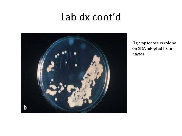 Lab dx cont’d Fig cryptococcus colony on SDA adopted from Kayser 