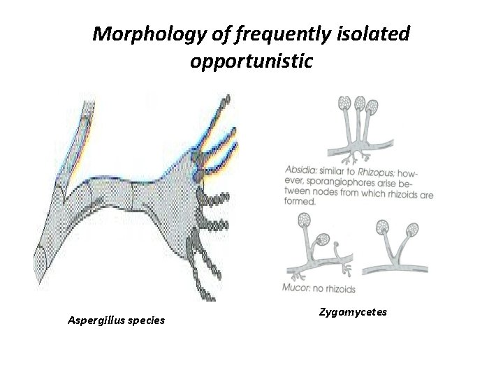 Morphology of frequently isolated opportunistic Aspergillus species Zygomycetes 