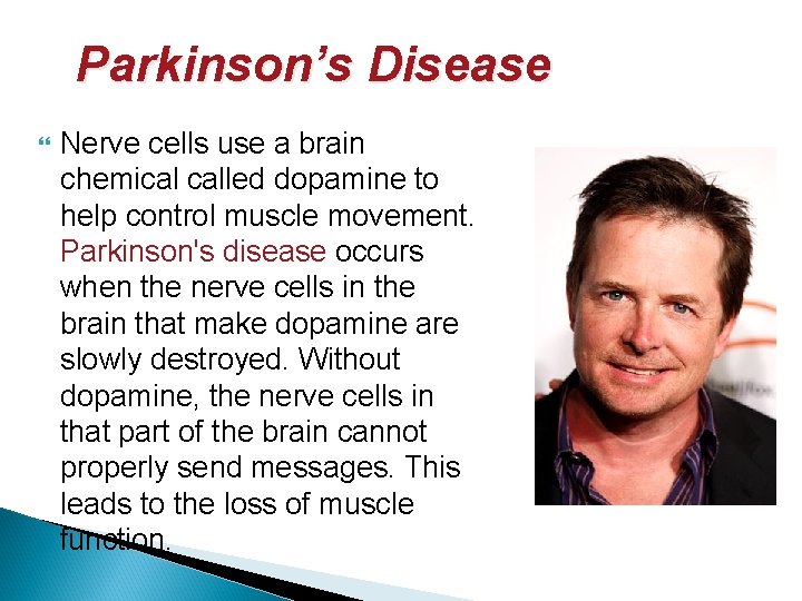 Parkinson’s Disease Nerve cells use a brain chemical called dopamine to help control muscle