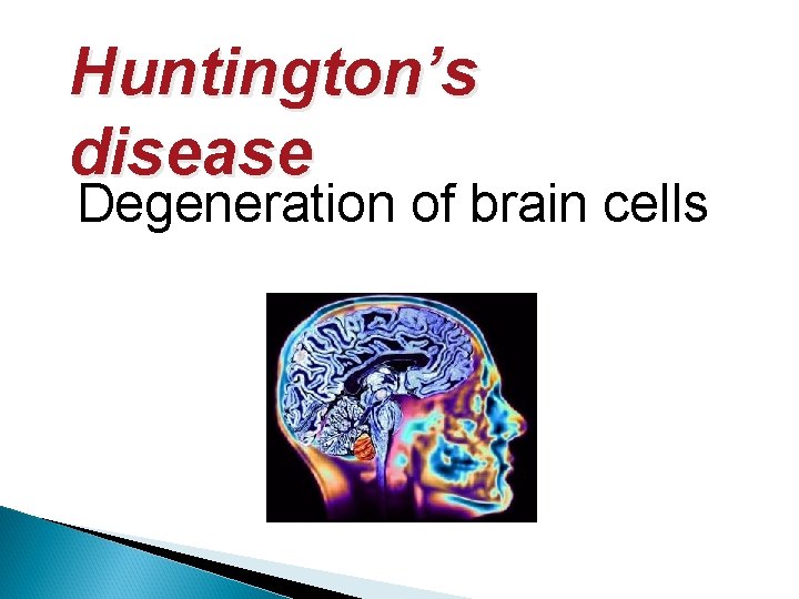 Huntington’s disease Degeneration of brain cells 