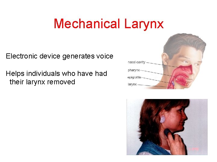 Mechanical Larynx Electronic device generates voice Helps individuals who have had their larynx removed