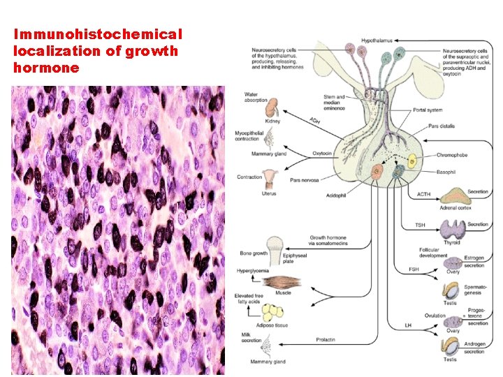 Immunohistochemical localization of growth hormone 