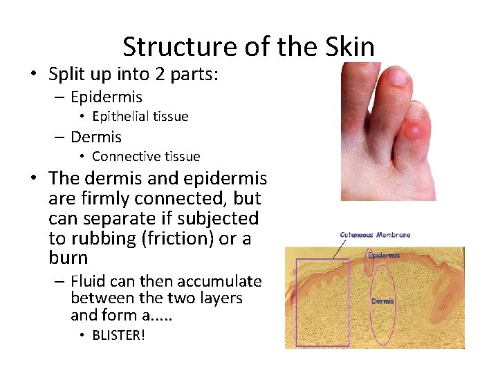 Structure of the Skin • Split up into 2 parts: – Epidermis • Epithelial