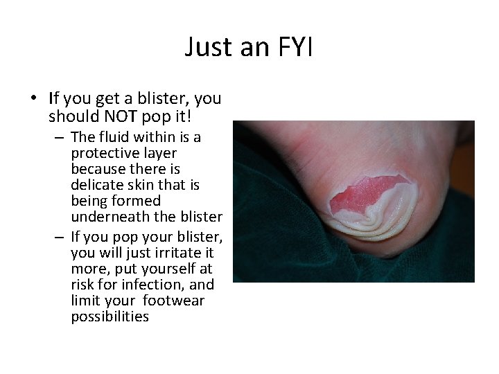 Just an FYI • If you get a blister, you should NOT pop it!