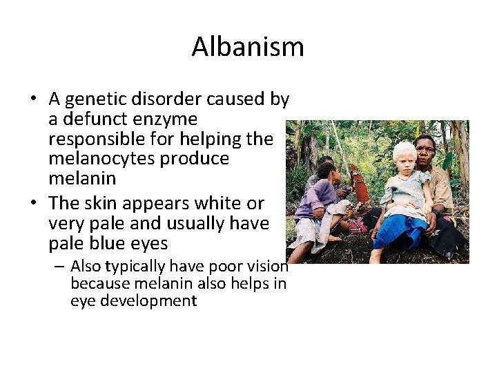 Albanism • A genetic disorder caused by a defunct enzyme responsible for helping the
