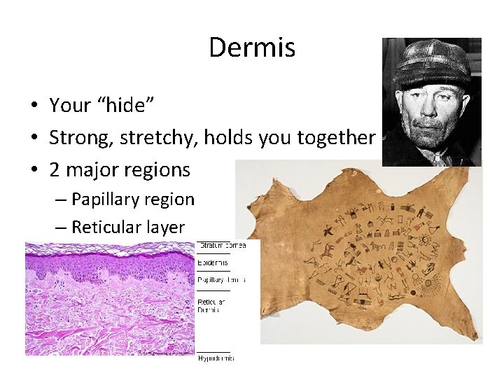 Dermis • Your “hide” • Strong, stretchy, holds you together • 2 major regions