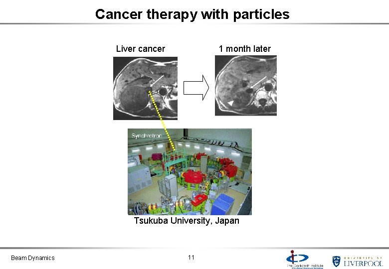 Cancer therapy with particles Liver cancer 1 month later Tsukuba University, Japan Beam Dynamics