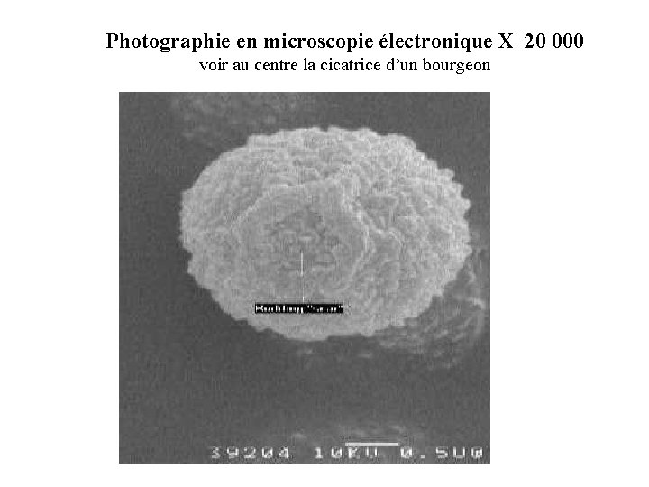 Photographie en microscopie électronique X 20 000 voir au centre la cicatrice d’un bourgeon