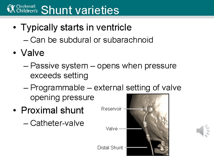 Shunt varieties • Typically starts in ventricle – Can be subdural or subarachnoid •