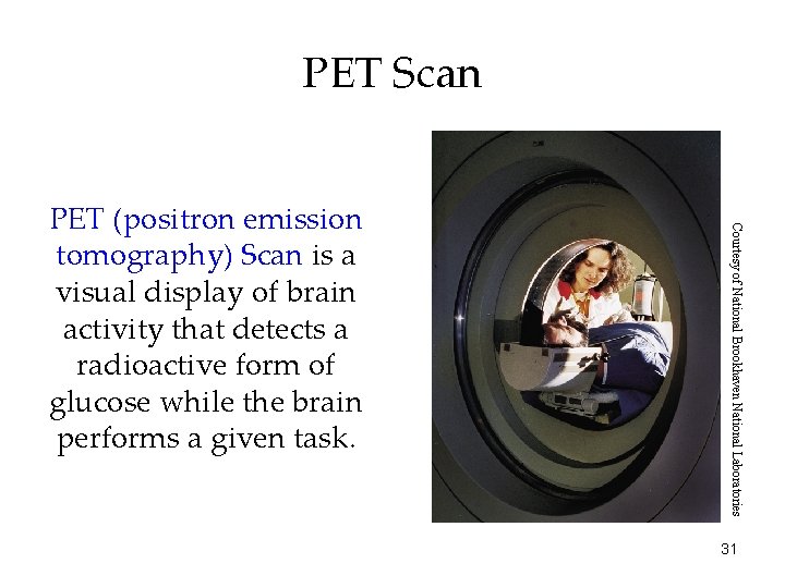 PET Scan Courtesy of National Brookhaven National Laboratories PET (positron emission tomography) Scan is