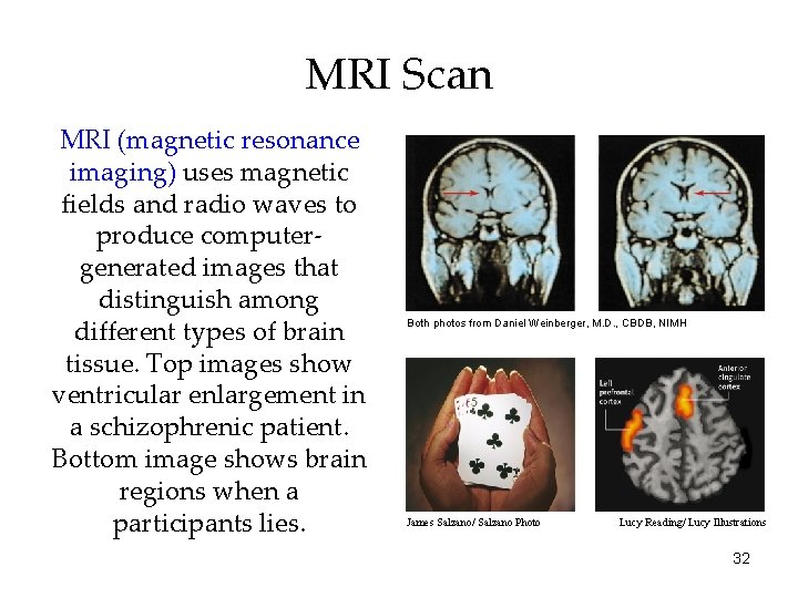 MRI Scan MRI (magnetic resonance imaging) uses magnetic fields and radio waves to produce