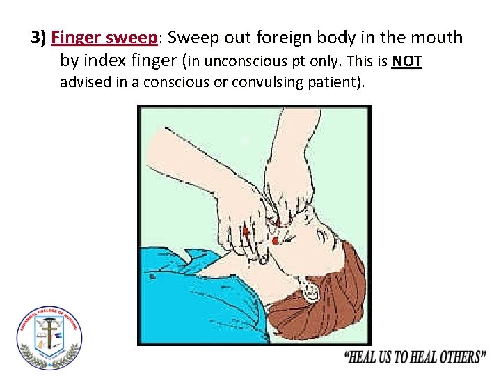 3) Finger sweep: Sweep out foreign body in the mouth by index finger (in