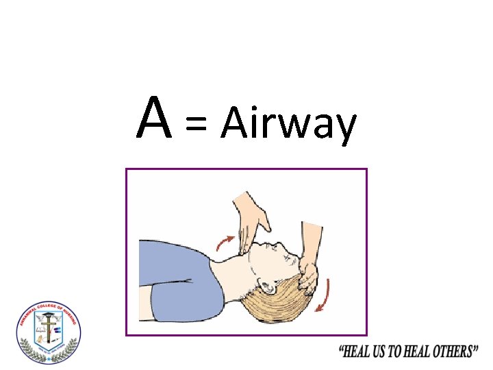 A = Airway 