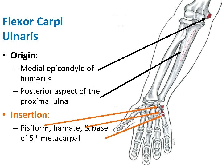 Flexor Carpi Ulnaris • Origin: – Medial epicondyle of humerus – Posterior aspect of