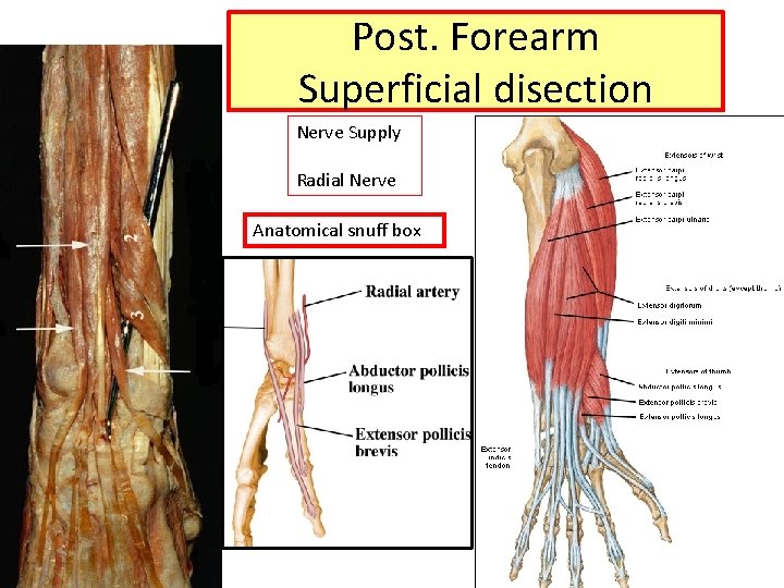 Post. Forearm Superficial disection Nerve Supply Radial Nerve Anatomical snuff box 