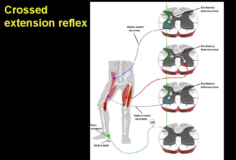 Crossed extension reflex 