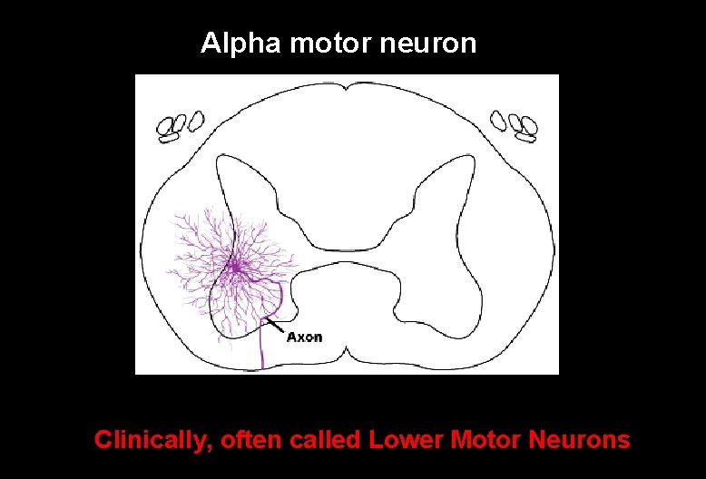 Alpha motor neuron Clinically, often called Lower Motor Neurons 