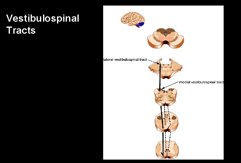Vestibulospinal Tracts 