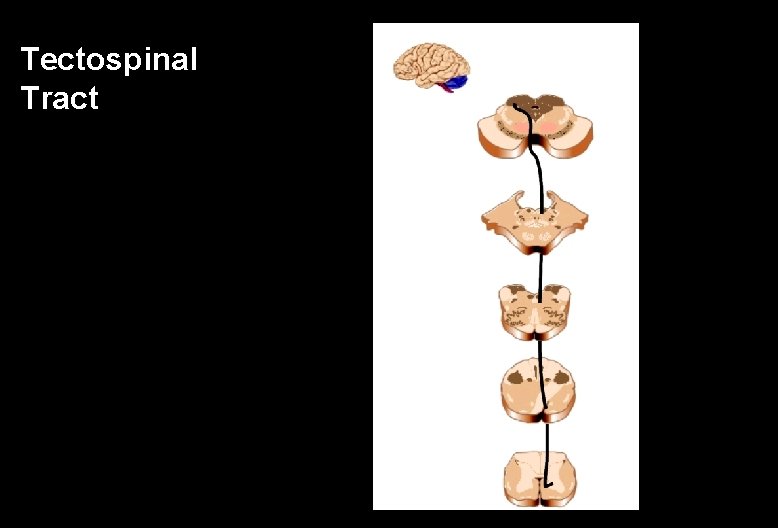 Tectospinal Tract 