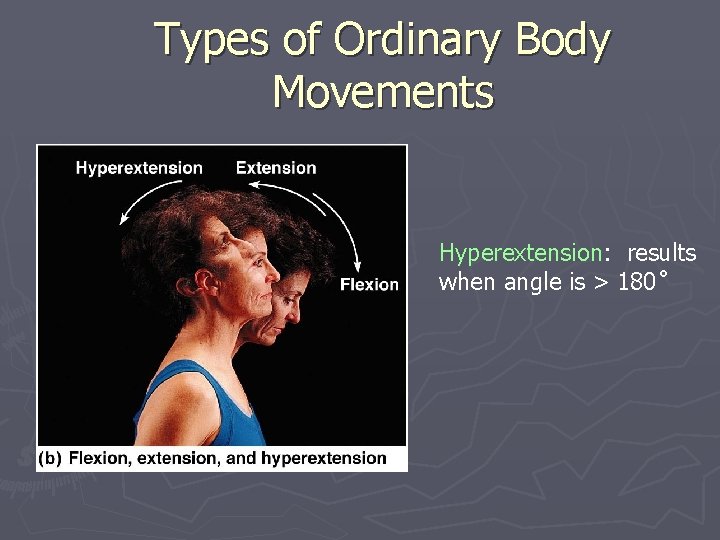 Types of Ordinary Body Movements Hyperextension: results when angle is > 180 