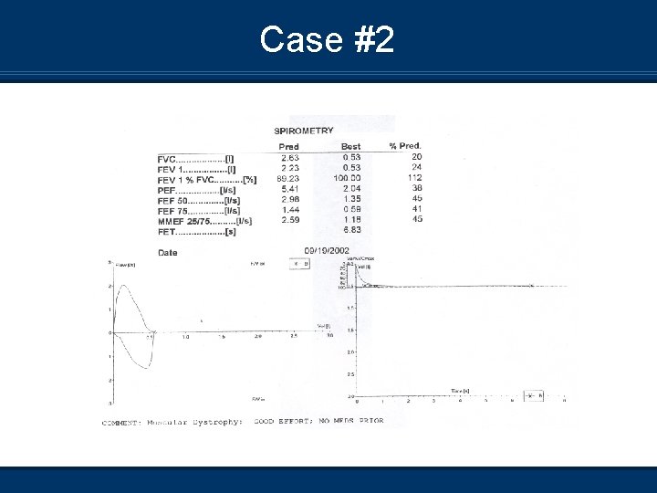 Case #2 