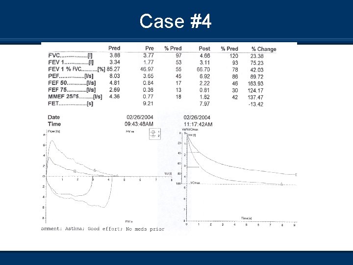 Case #4 