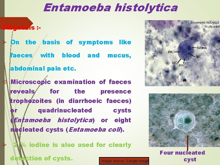Entamoeba histolytica Diagnosis : - Ø On the basis of symptoms like faeces with