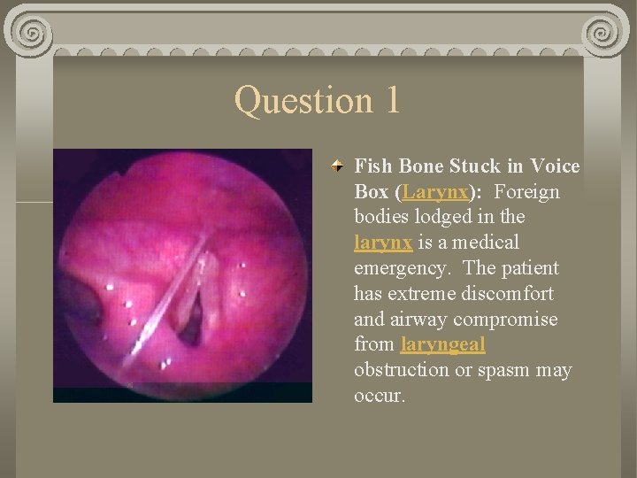 Question 1 Fish Bone Stuck in Voice Box (Larynx): Foreign bodies lodged in the
