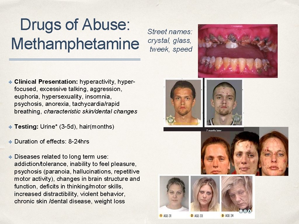Drugs of Abuse: Methamphetamine ✤ Clinical Presentation: hyperactivity, hyperfocused, excessive talking, aggression, euphoria, hypersexuality,