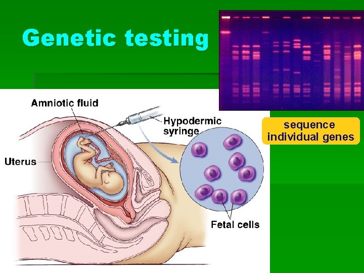 Genetic testing sequence individual genes 
