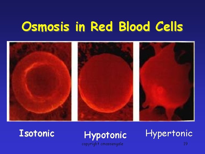 Osmosis in Red Blood Cells Isotonic Hypotonic copyright cmassengale Hypertonic 19 