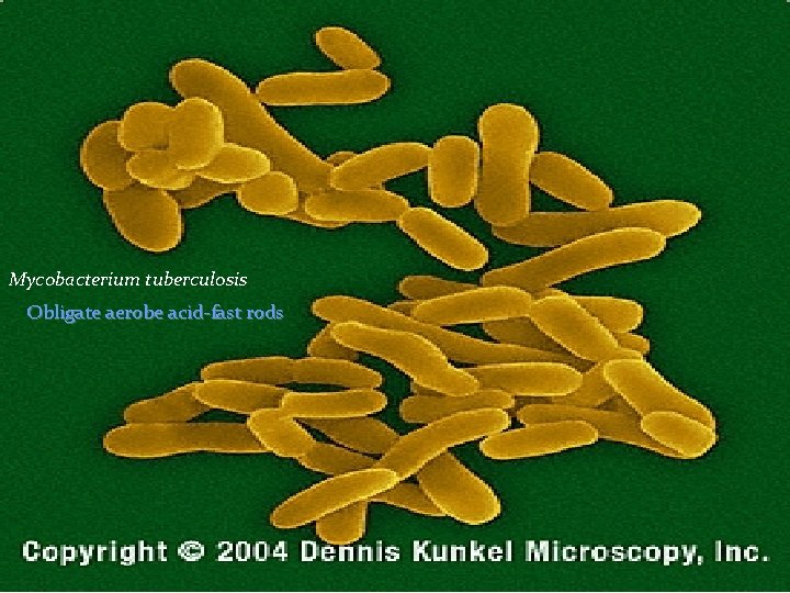 Mycobacterium tuberculosis Obligate aerobe acid-fast rods 