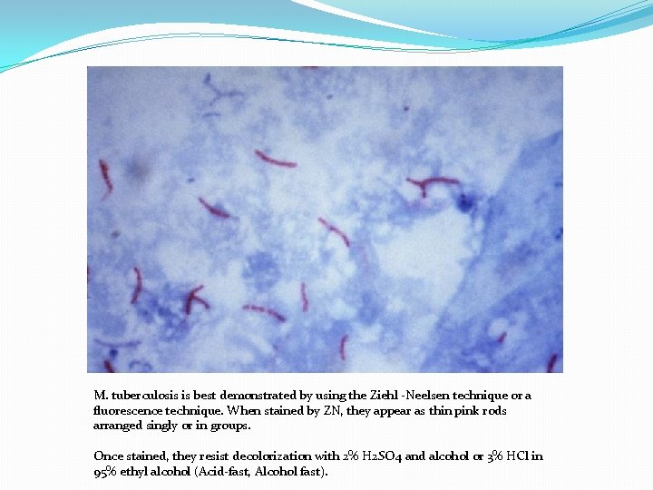 M. tuberculosis is best demonstrated by using the Ziehl -Neelsen technique or a fluorescence