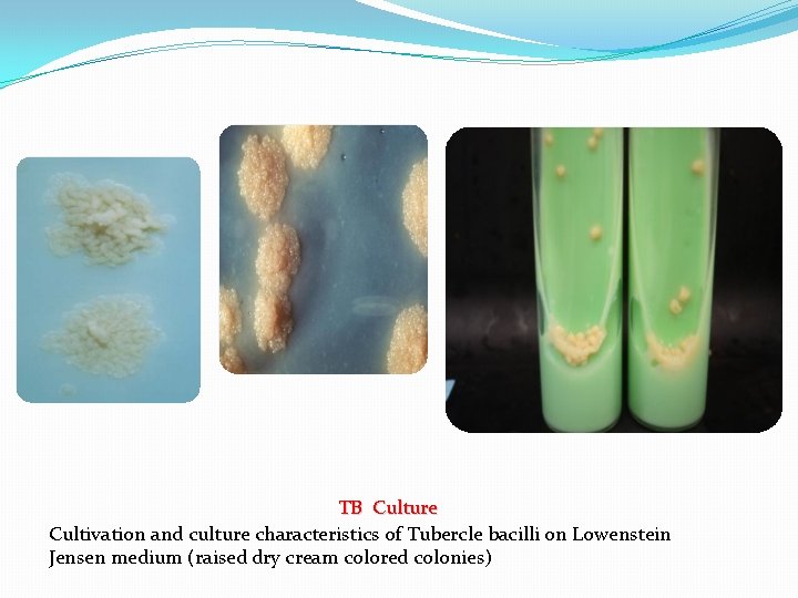 TB Culture Cultivation and culture characteristics of Tubercle bacilli on Lowenstein Jensen medium (raised