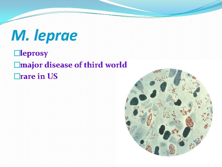 M. leprae �leprosy �major disease of third world �rare in US 