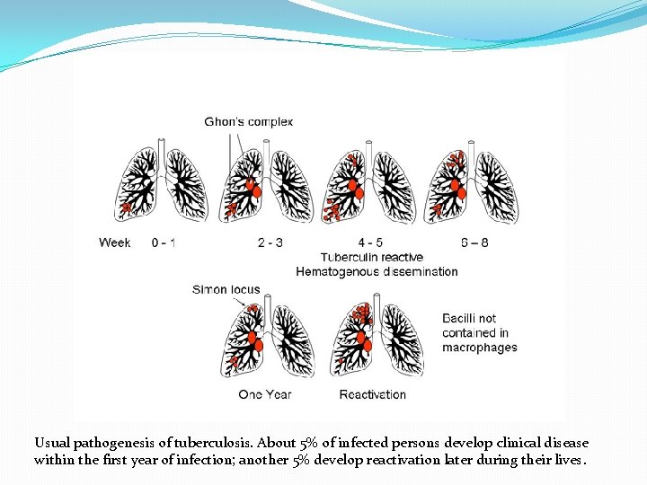 Usual pathogenesis of tuberculosis. About 5% of infected persons develop clinical disease within the