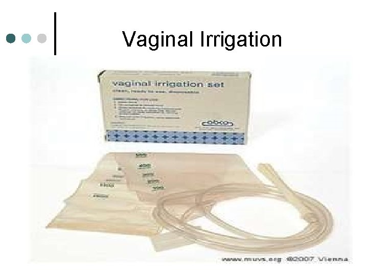 Vaginal Irrigation 