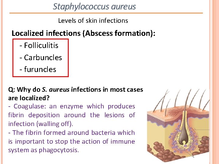 Staphylococcus aureus Levels of skin infections Localized infections (Abscess formation): - Folliculitis - Carbuncles